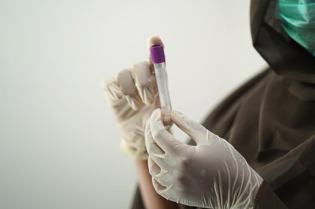Fler fall av tarmcancer upptäckta – framgång med screening