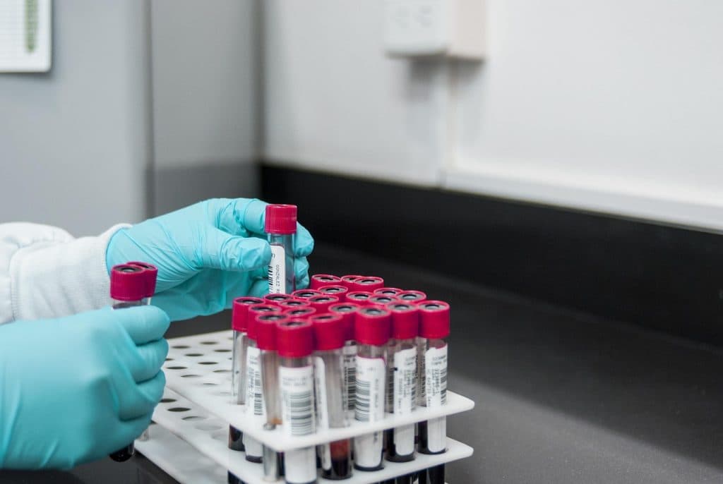 Ny blodprovsanalys för cancer – revolutionerar cancervården